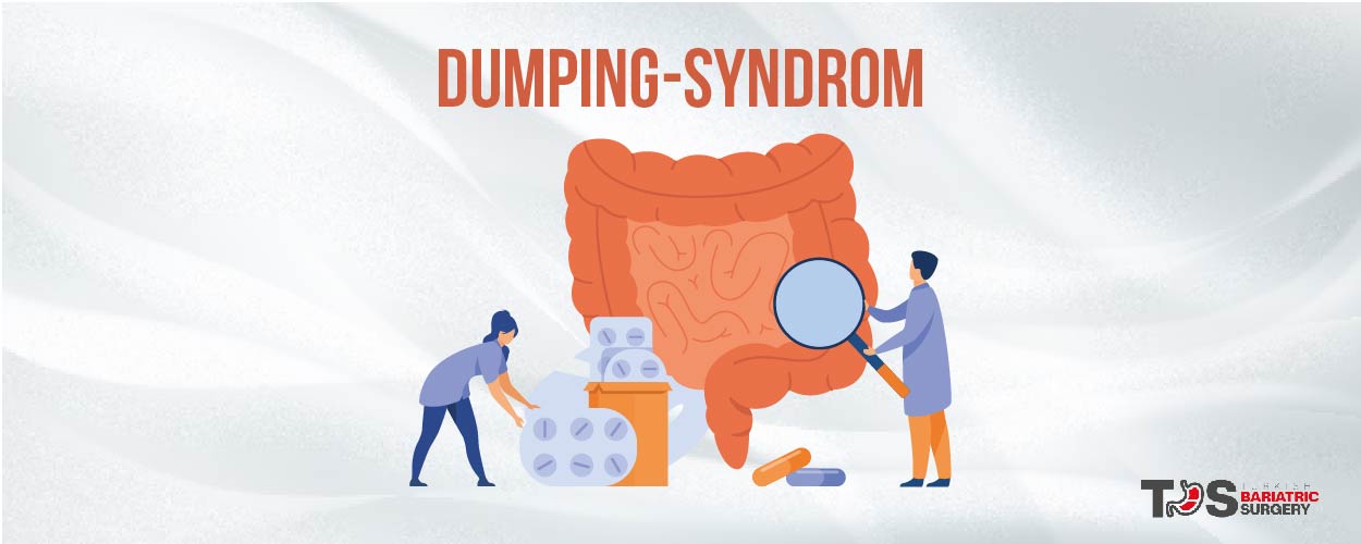 dumping-syndrom-turkish-bariatric-surgery